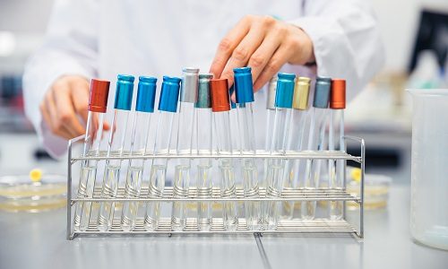 Laboratorium buisjes